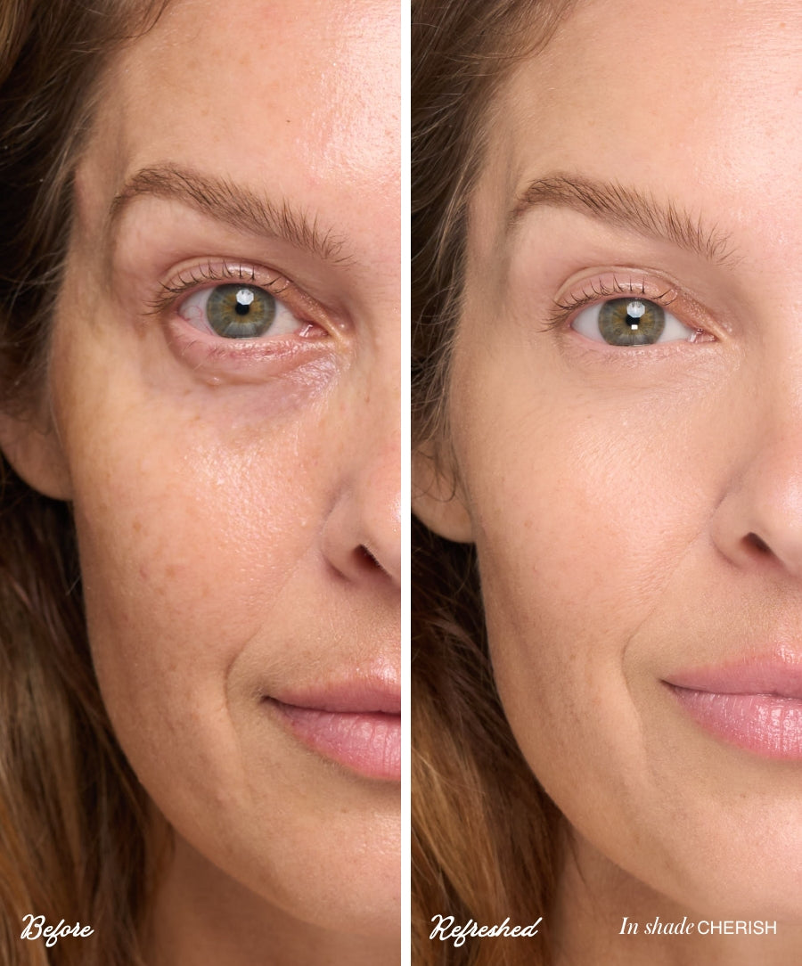 Close-up comparison of a woman's face before and after using ReFresh Eye Brightener Broad Spectrum SPF 30 + Correcting Tint in shade Cherish, showing smoother skin and reduced under-eye darkness with natural, radiant coverage.