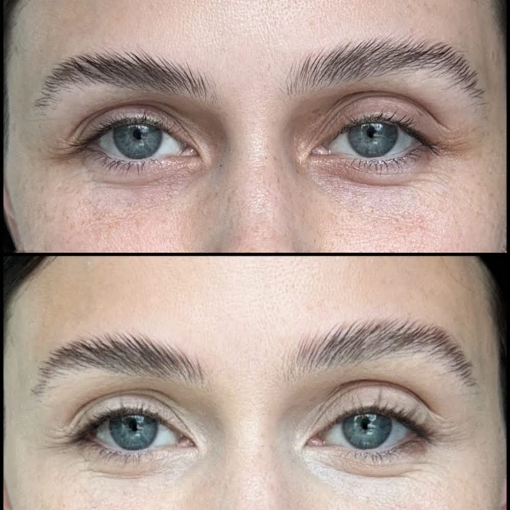 Learn How to Get Rid of Red Spots on Your Face 